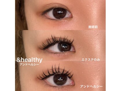 ミニョンプラス(Mignon+)の写真