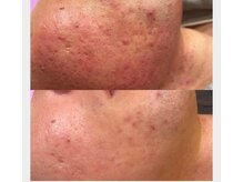ラヴィエール(Laviere)の雰囲気（肌のトラブルケア、エイジングケアなんでもご相談下さい）