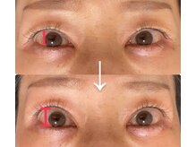 リヒト(Licht)/アイパワーエステ