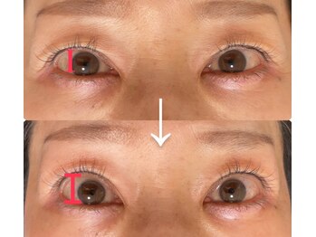 リヒト(Licht)/アイパワーエステ