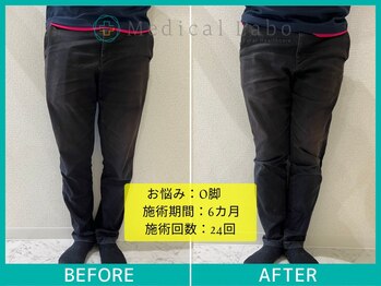 岐阜各務原整体院/O脚・X脚の方