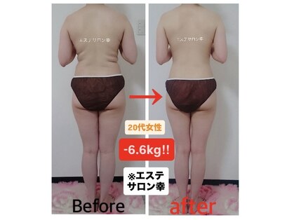 エステサロン 幸の写真