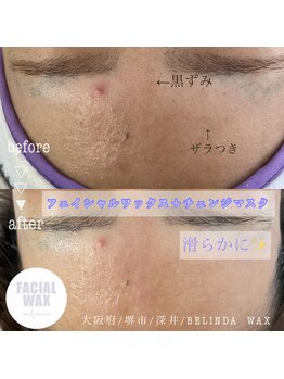 ベリンダ ワックス(BELINDA WAX)/お肌も滑らかに♪