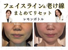 モテ美白