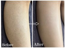 ハダハダ(HADA HADA Medical Esthetic)