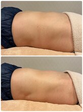 ビューティーサロン ラグジューム(Beauty salon Laxum)/赤岩式腸けずり