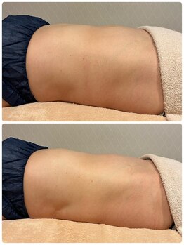 ビューティーサロン ラグジューム(Beauty salon Laxum)/赤岩式腸けずり