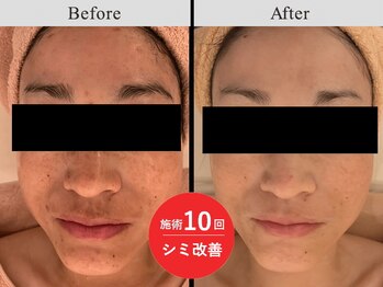 メディカルフェイシャルエステティック サロン ド ヴェリテ(VERITE)/