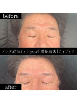 ユー 千葉駅前店(you)/ビフォ－アフター写真