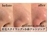 NEW☆【黒ずみ解消◎】眉毛スタイリング＋小鼻クレンジング（機械選択可）