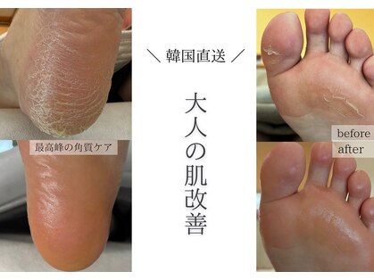 フットミー(foot mii)の写真