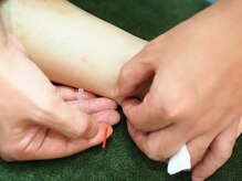 鍼灸治療室ピア/手足のツボを使います