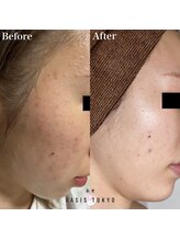 ネオオアシストウキョウ(ネオ OASIS TOKYO)/