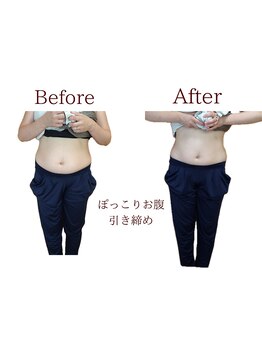 整体院トトノエル 西川原院/Before→After