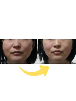 シエスタ 新小岩/横に広がった骨格をコンパクトに