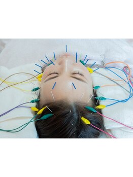 小顔になりたい