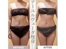 アートスタイル(Art Style)の雰囲気（本気のデトックス♪before・afterの写真がこちら♪）