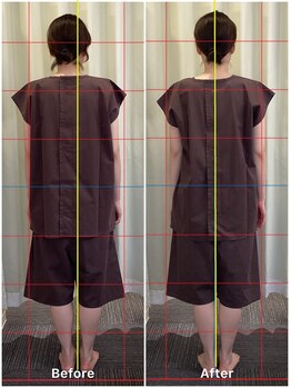 鍼灸 整体院 ひわたし/◇ゆがみ姿勢をなおしたい！