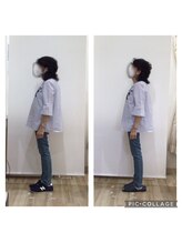 はぴねす鍼灸整骨院 玉造院/姿勢矯正　before/after