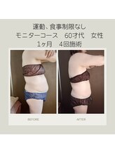 キセキ KISEKI リラクゼーション/最強×最新マシンでサイズダウン