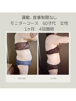 キセキ KISEKI リラクゼーション/最強×最新マシンでサイズダウン