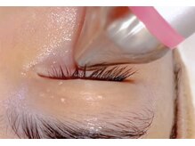 リサプリ(Re: Supple)の雰囲気（ポイントアプローチ！目元に湧き上がるハリ感を◎）