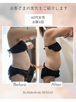 アンドユー(&U)/