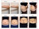 エルミューノ(elμno)の写真