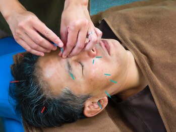 ナディ鍼灸治療院/美容鍼