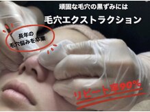 ミー(美mee)の雰囲気（リピート率90%! 長年の毛穴悩み直ぐに解消できる毛穴ケア）