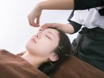 みなとはり灸治療院の写真/国家資格を持つ女性鍼灸師による本格的な鍼施術！お客様のニーズに合わせたオーダーメイド施術を提供◎