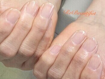 リ ビューティフル(Re Beautiful)の写真/硬い甘皮/角質/噛み爪/爪周りのゴワゴワ等…あなたが抱える爪のお悩み、当店で解消していきませんか？