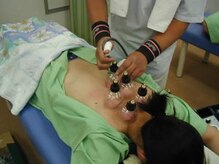 整体院もみのき 土浦本店/吸い玉（カッピング）1