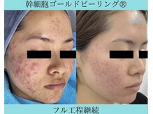 リメイククリニカルビューティー(Remake clinical beauty)/