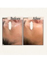 ハーティー(Hearty)/