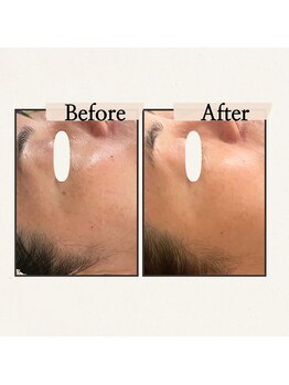 ハーティー(Hearty)/