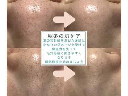 ピュリフィケーション(Purification)の写真