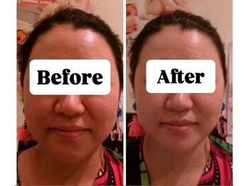 マンマ ジュンナ/【浜松/小顔/小顔矯正】