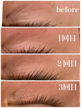 シャインクラフト/ハイパーナイフでエイジングケア