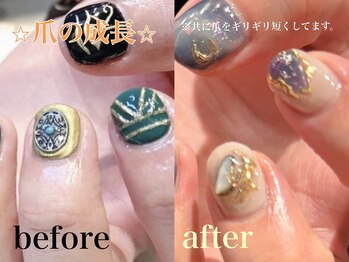 ユニックス サロンアンドスパ UNIX Salon&Spa 浦和美園店/爪の成長ビフォーアフター