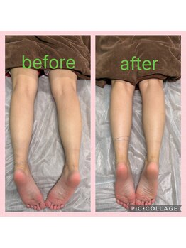 カピリナ(kapilina)/リンパマッサージ１回での効果