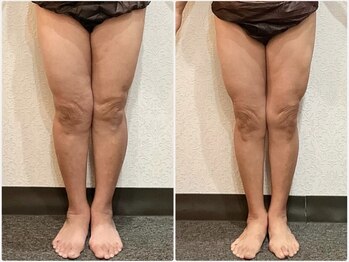 美容整体 ウェリナ 蟹江院/小顔矯正/骨盤矯正/美脚サロン