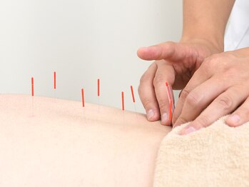 区役所前はりきゅう整骨院の写真/【SNSでバズり中】首肩こり/腰痛/自律神経の不調等、身体の内側からくる慢性的な不調を根本改善します◎