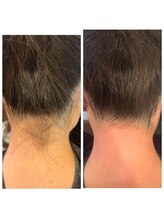 アットユウ(@yu)/シュガーリング《うなじ》