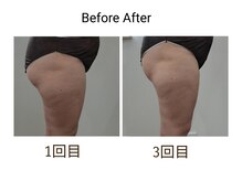 レスプロンディール(Resplendir)/