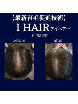 デン(DEN)/育毛促進　ビフォーアフター