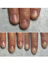 貝爪もまっすぐな縦長爪へ