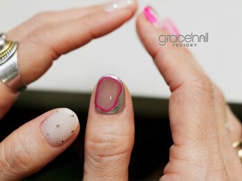 ART5本・フィルイン/まつやま