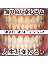 ライトビューティー 銀座店(LightBeauty)/東銀座 ホワイトニング 症例写真