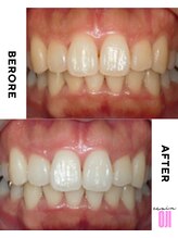 エクシアホワイトニング 王寺店/